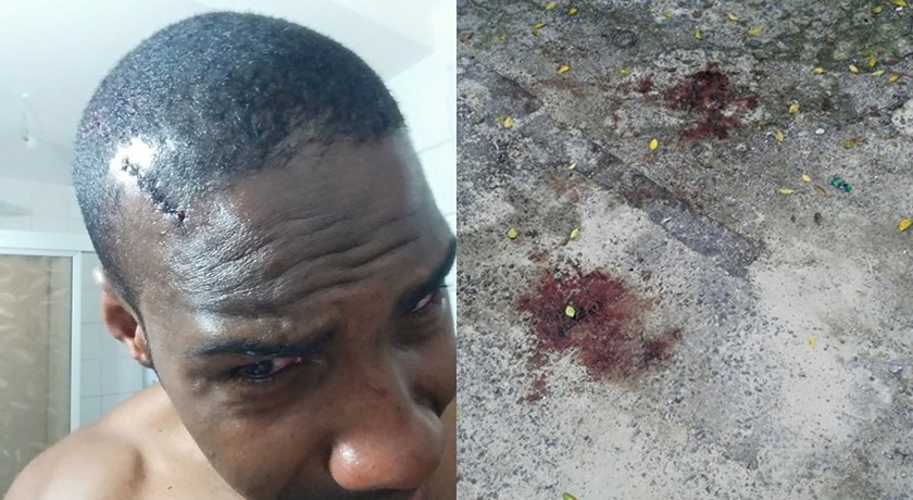 Jornalista acusa policiais militares de agressão após registrar espancamento no Bonfim