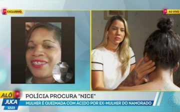 Alô Juca: mulher é atacada com ácido pela ex-namorada do companheiro